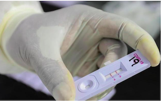 AND Fast Anti-Body Tests Approved for Public Use
