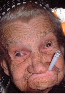 30-year old after Jab